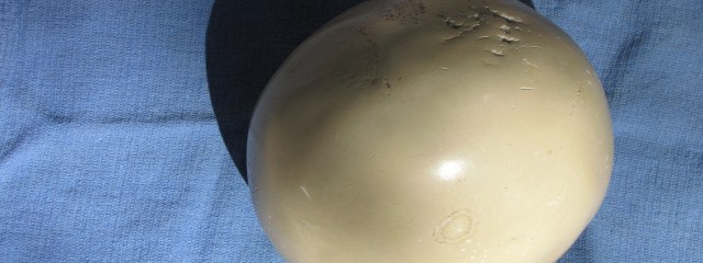 Enteroliths are stones that form inside the intestinal tract.